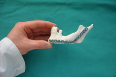 Na Politechnice Rzeszowskiej powstał model żuchwy wykonany techniką druku 3D